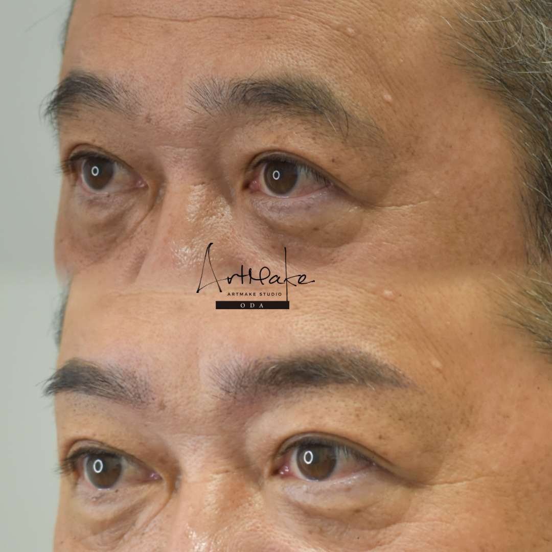 メンズ眉アートメイクの症例画像｜毛並み｜平行眉