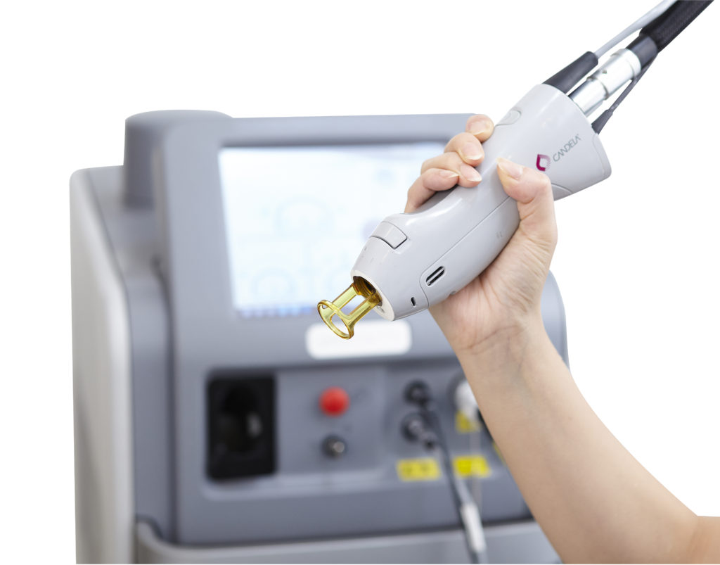 日焼けしにくい季節こそ脱毛がおすすめ！ ReVIOS メンズ美容クリニック